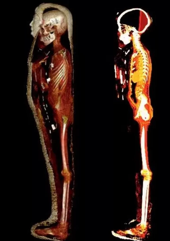 Scientists Discover Secrets of 2,300-year-old ‘Golden Boy’ Mummy